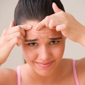 El acnÃ© en los adolescentes